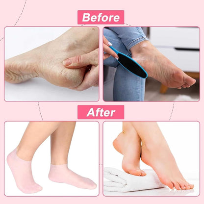 Happy Feet - Pedicure Silicon Gel Socks