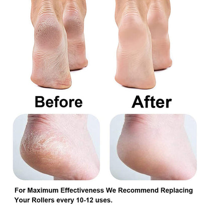 Pedicure Foot Reviver