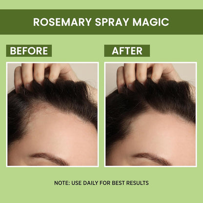 Rosemary Hair Regrowth Tonic Spray (Pack of 2 Bottle and 1 Sprayer)